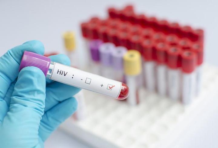 İngiltere’nin konuştuğu HIV skandalı