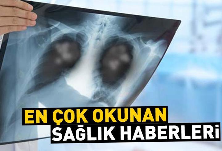 6 Ağustos 2024 günün öne çıkan sağlık haberleri…